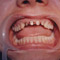 aaaaaaaa