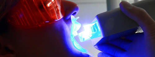 Décoloration dentaire avec le système de blanchiment sur la chaise du dentiste par ZOOM!