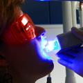 Dentisterie cosmétique