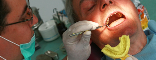Implant Dentaire
