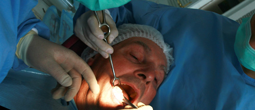 Implant Dentaire