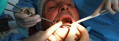 Implant Dentaire